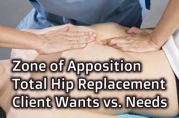 Zone of Apposition, Total Hip Replacement, and Client Wants vs Needs ...