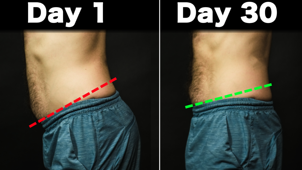 Anterior Pelvic Tilt Fix It For Good Zaccupples