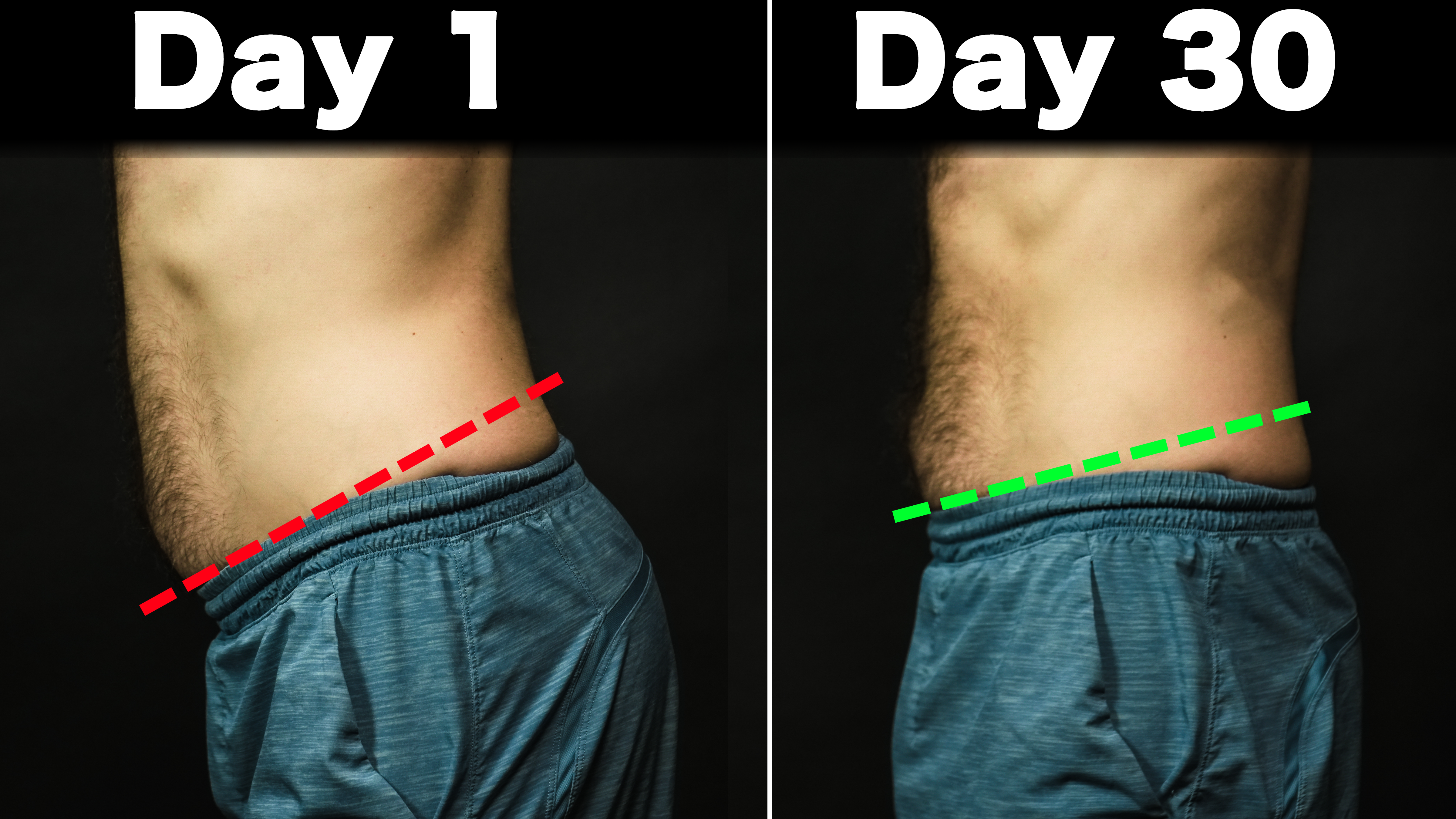 Anterior Pelvic Tilt – Fix It For Good – ZacCupples.com